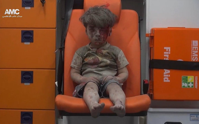 „Scanpix“ nuotr./Sužeistas penkiametis Alepe