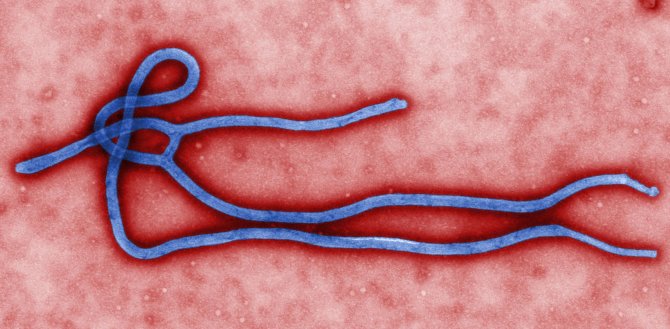 AFP/„Scanpix“ nuotr./Ebolos virusas