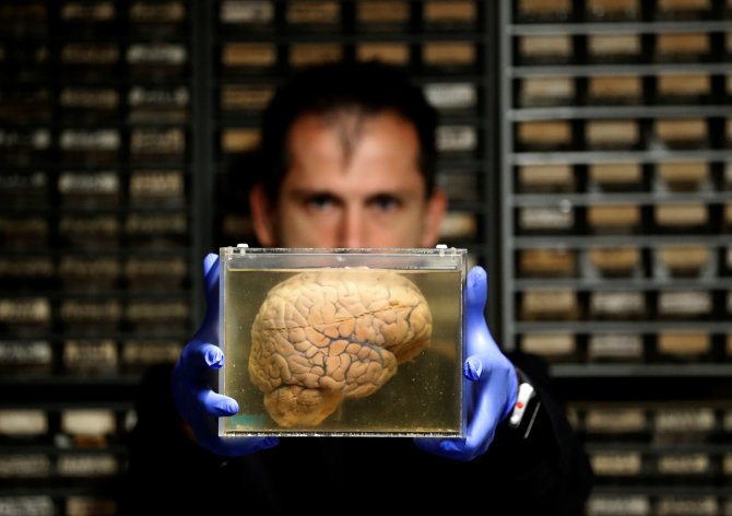 „Reuters“/„Scanpix“ nuotr./Muziejaus eksponatas – fiksuotos žmogaus smegenys