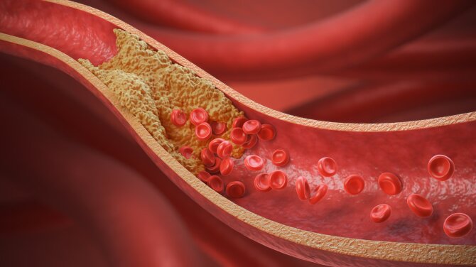 Shutterstock nuotr./Cholesterolis