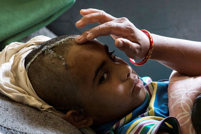AFP/„Scanpix“ nuotr./Sužeistas vaikas Nepale