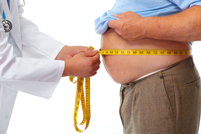 123rf.com/„Pasitelkęs nutukimą gydančias operacijas žmogus gali atsikratyti iki 70 proc. perteklinės kūno masės“, – įsitikinęs profesorius G.Brimas