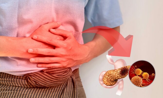 Shutterstock nuotr./Kasos vėžys