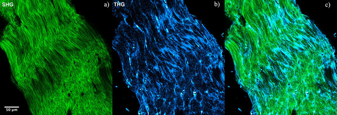 Žurnalas „Spectrum“/Daugiamodžiu netiesiniu poliarizaciniu mikroskopu gauti vaizdai. Žiurkės uodegos sausgyslės pjūvio vaizdas (a – antrosios harmonikos generacija, b – trečiosios harmonikos generacija, c – abu signalai viename vaizde). Kolagenų baltymai žali, o ląstelių branduoliai ir fascijos mėlyni. 
