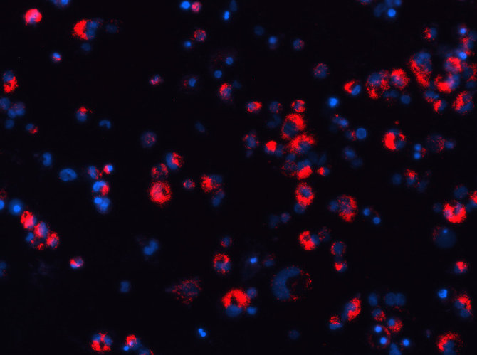 Tyrėjų nuotr./Makrofagai, fagocitavę raudonai švytinčias daleles. Fluorescencinė mikroskopija