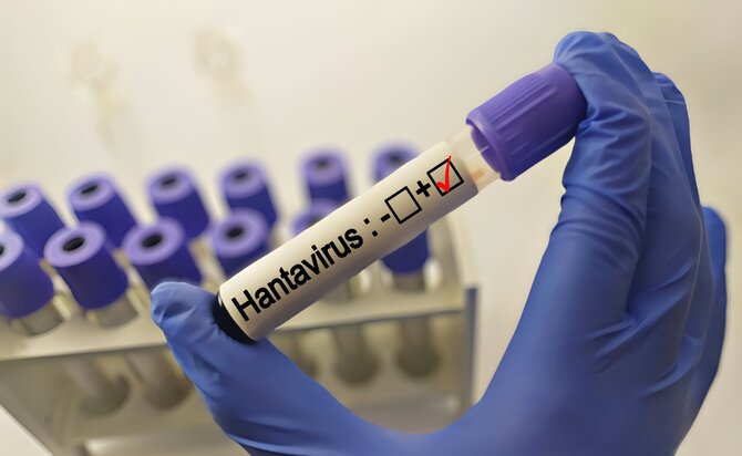 Shutterstock nuotr./Hantavirusas