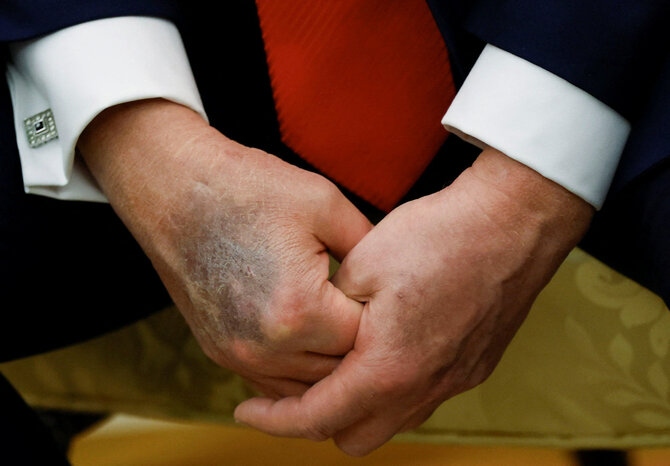 Scanpix nuotr./Donaldo Trumpo ranka