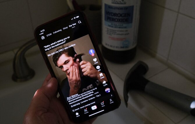 AFP/„Scanpix“ nuotr./Influenceris bando koreguoti veidą