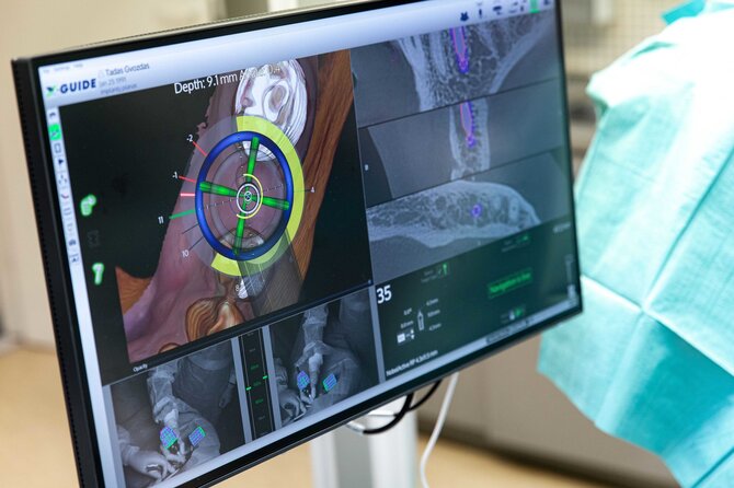 Kauno implantologijos klinikos nuotr./Navigacinė implantacija: kaip GPS technologija keičia dantų atkūrimą