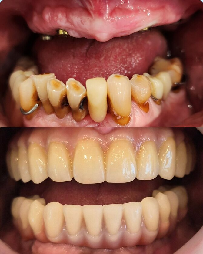 „Denticija“ nuotr./Gydymo rezultatas prieš ir po
