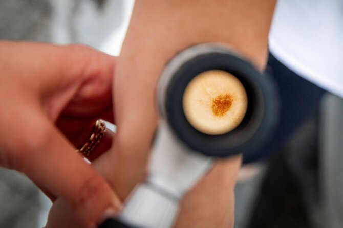„Sapiegos klinikos“ nuotr./Euromelanomos diena: nemokami profesionalūs tyrimai ir išgelbėtos gyvybės