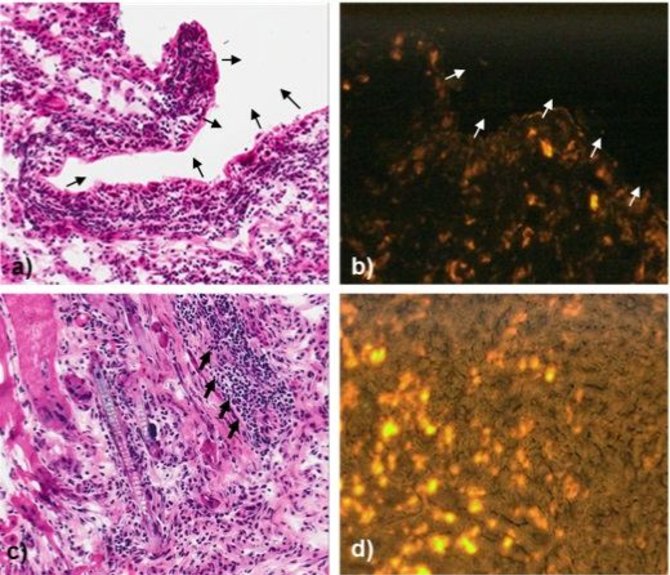 Žurnalo SPECTRUM iliustr./Žiurkės audinių, į kuriuos implantuotas nestruktūrizuotas PDMS su endotelio ląstelėmis, histologiniai vaizdai, įrodantys PDMS karkaso biosuderinamumą