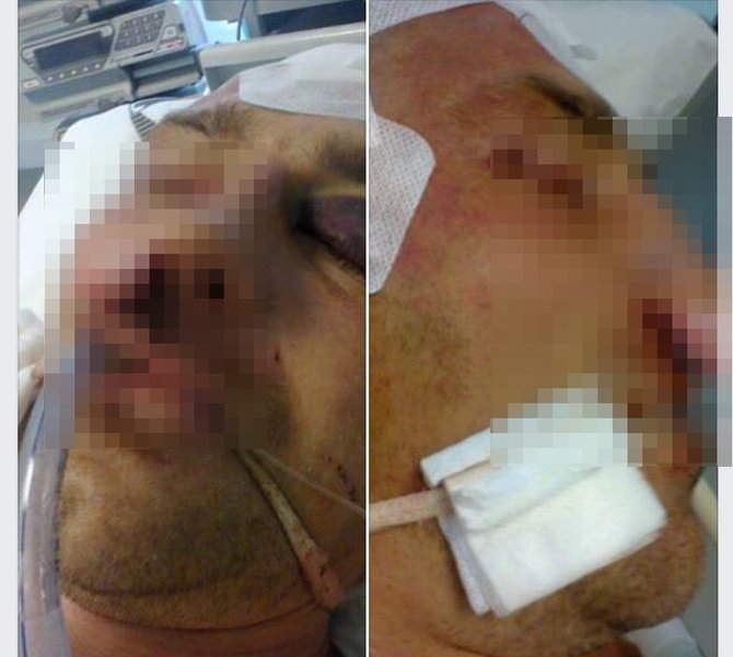 Nuotraukos iš „Facebook“/Socialiniame tinkle paviešintos nuotraukos, kaip atrodo ligoninėje gydomas vyras