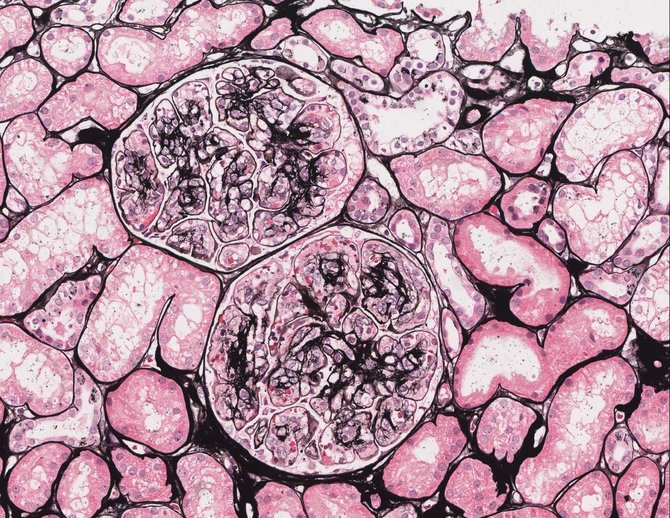 VUL Santaros klinikų nuotr./VPC Inkstų glomerulų membranas išryškinantis dažymo metodas