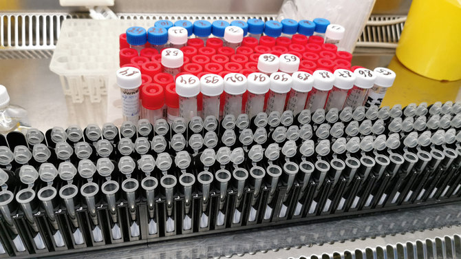 Pranešimo žiniasklaidai autorių nuotr./Mėgintuvėliai laboratorijoje