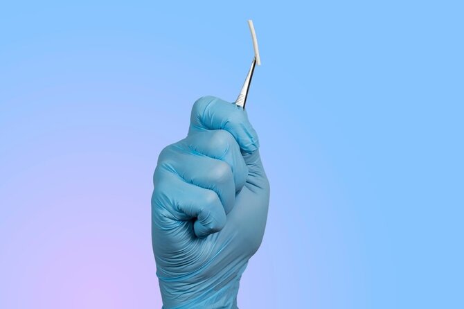 Shutterstock nuotr./Kontraceptinis implantas