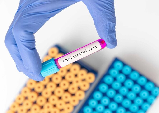 Shutterstock nuotr./Cholesterolis