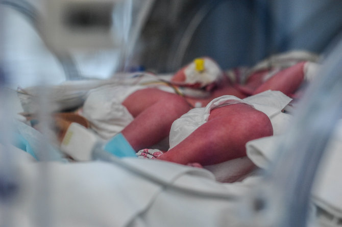Jurgitos Narbutaitės nuotr./Antradienį gimusios mergytės auga inkubatoriuje