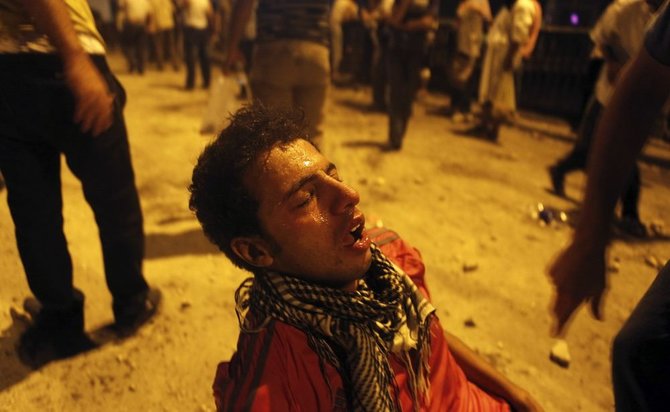 „Reuters“/„Scanpix“ nuotr./Nuo ašarinių dujų nukentėjęs vyras.