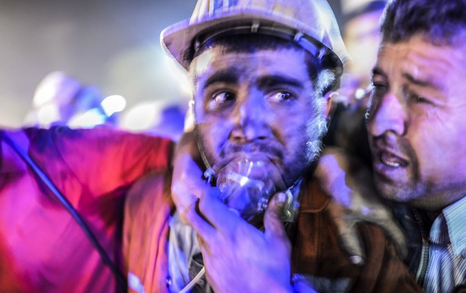 AFP/„Scanpix“ nuotr./Sužeistas angliakasys Turkijoje