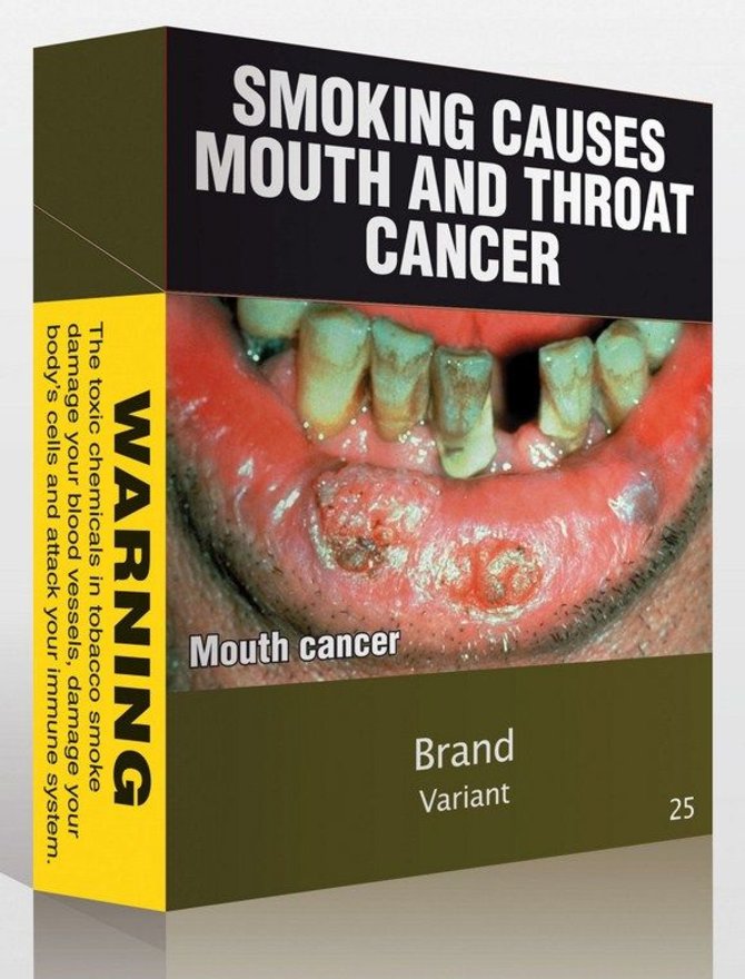AFP/„Scanpix“ nuotr./Australijoje pardavinėjami cigarečių pakeliai su perspėjimu „Rūkymas sukelia burnos ir gerklės vėžį“
