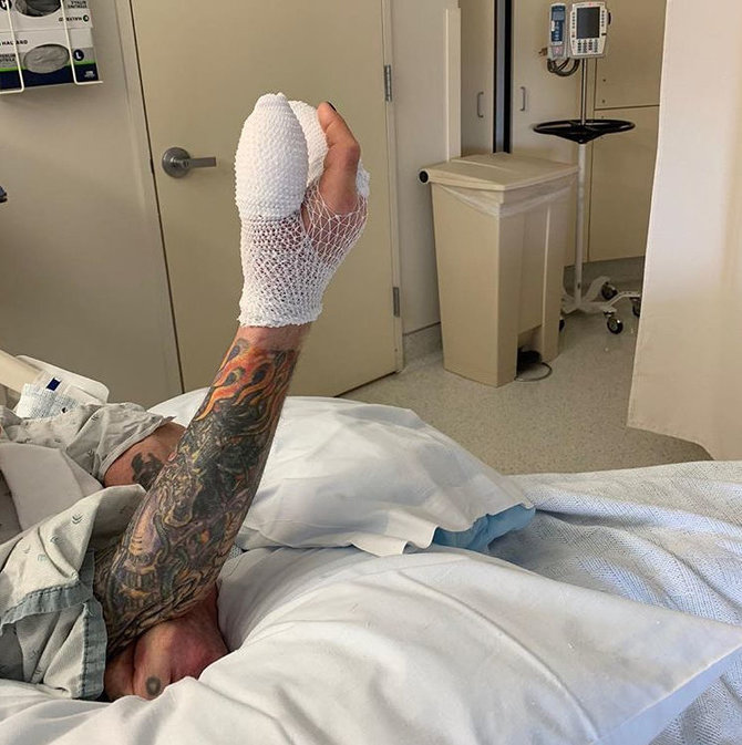 „Instagram“ nuotr./Ozzy Osbourne'as po operacijos