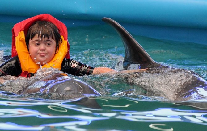 AFP/„Scanpix“ nuotr./Dauno sindromo paveiktų vaikų terapija su delfinais
