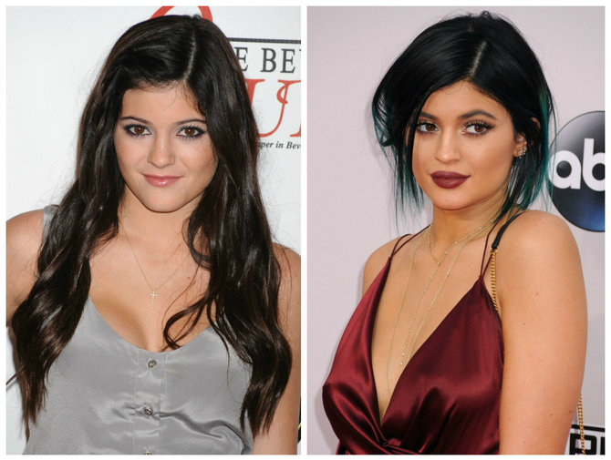 AOP ir „Scanpix“/SIPA nuotr./Kylie Jenner 2010 ir 2014 metais