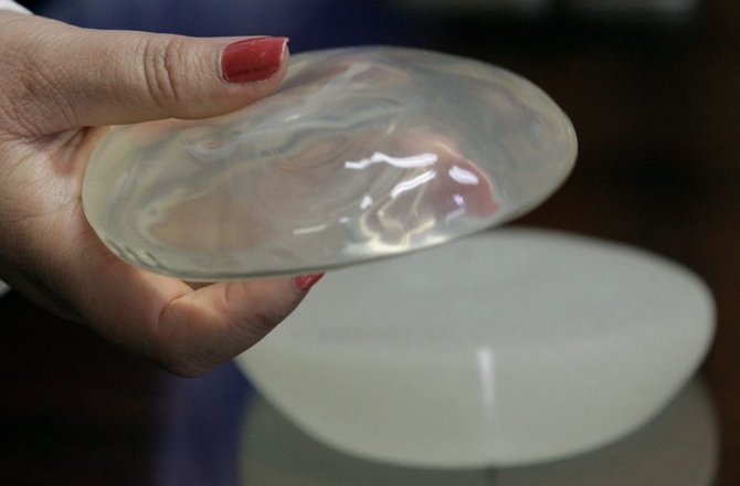AFP/„Scanpix“ nuotr./Silikoninių krūtų implantai