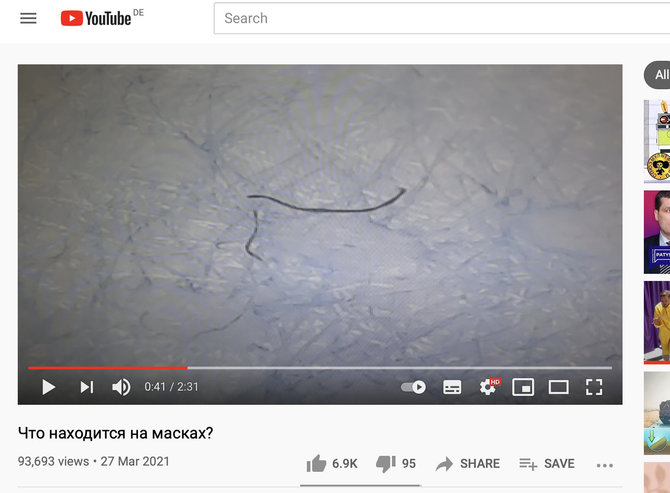 Ekrano nuotr. iš „YouTube“/Ant medicininės kaukės tariamai rasti kirminai