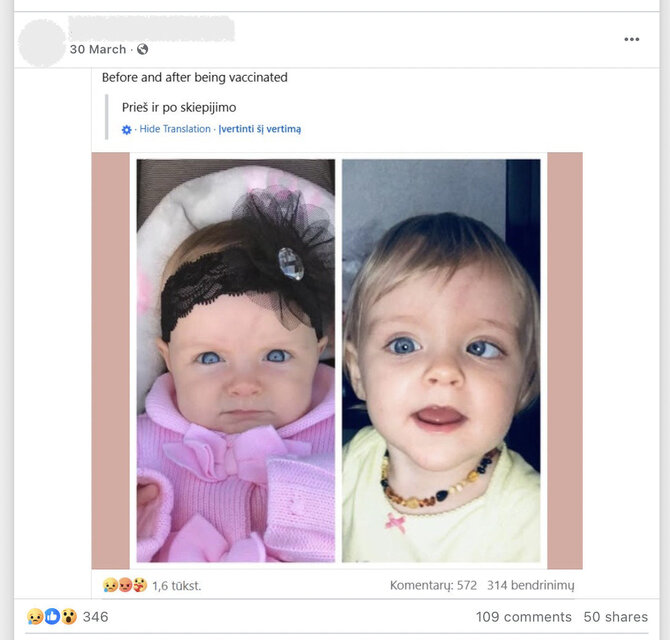 Ekrano nuotr. iš „Facebook“/Žvairumo priežastys paprastai tiksliai nežinomos, nėra mokslinių įrodymų, kad jį sukeltų vakcinos