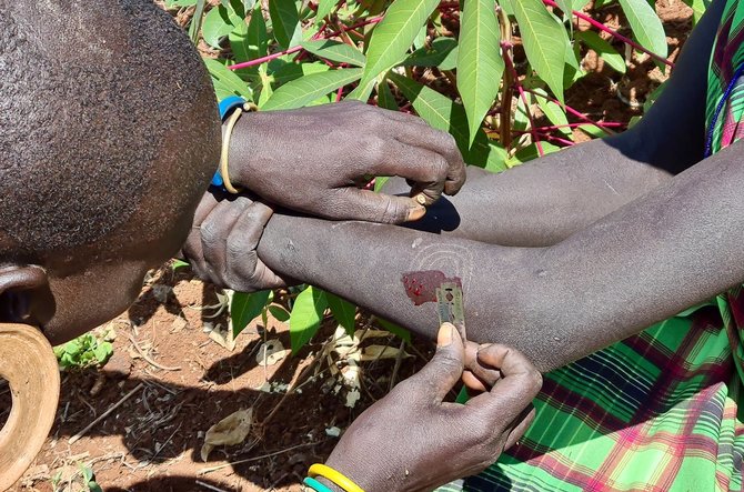 D.Pankevičiaus nuotr./Jaunos mergaites mėgsta puoštis randais, kurie susidaro po odos išpjaustinėjimo. Surma gentis. Etiopija