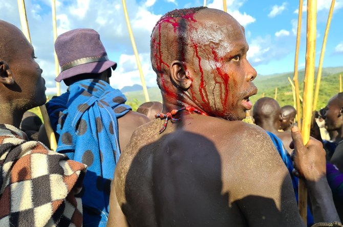 D.Pankevičiaus nuotr./Surma genties vyrai tarpusavyje kovoja lazdomis. Kraujo tikrai netrūksta. Surma gentis, Etiopija