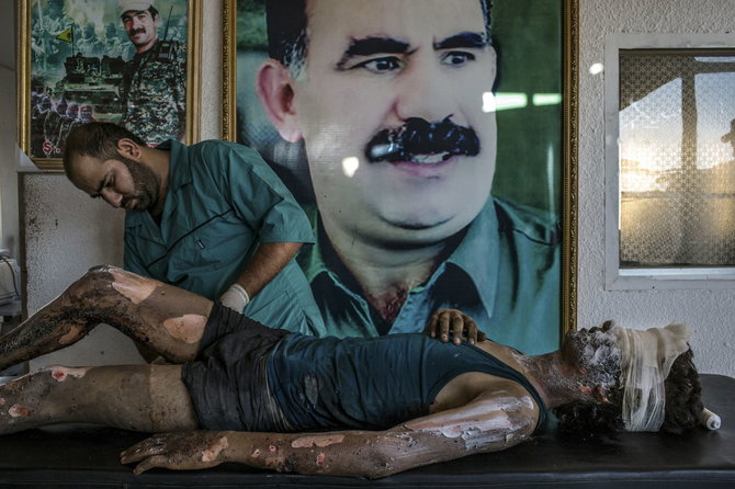 „Reuters“/„Scanpix“ nuotr./Ligoninė Sirijoje