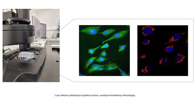 VU nuotr./Baltymų lokalizacijos ląstelėse tyrimai, naudojant konfokalinę mikroskopiją.