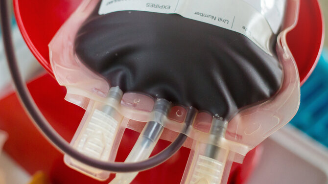 Santaros klinikų nuotr./Kaulų čiulpų donorystė