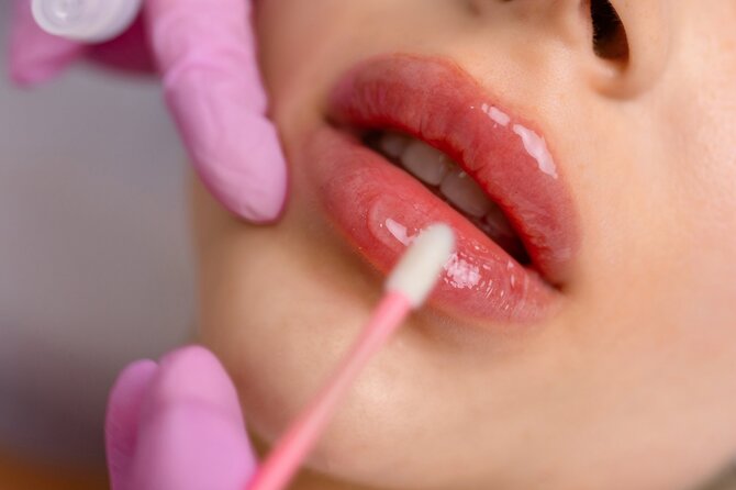 Shutterstock nuotr./Lūpų putlinimas