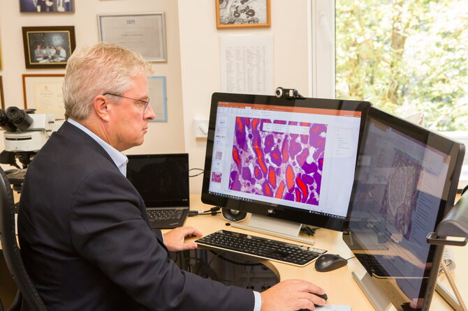 Santaros klinikų nuotr./Prof. Arvydas Laurinavičius