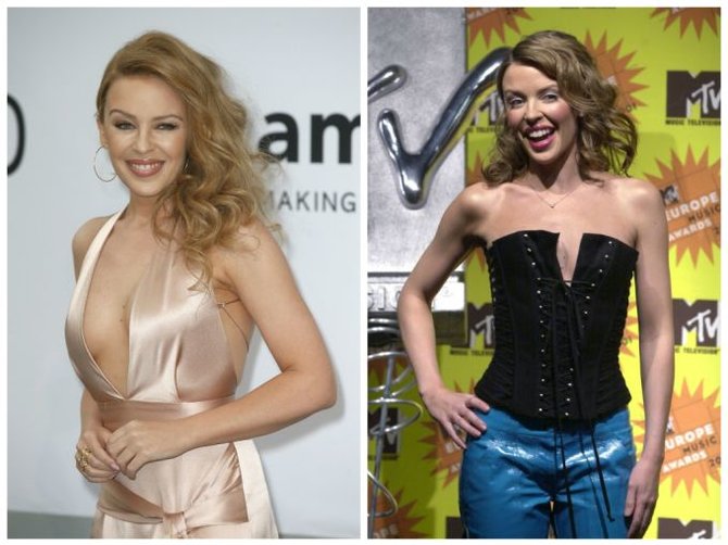 „Scanpix“ nuotr./Kylie Minogue (kairėje 2014 m., dešinėje - 2001 m.)