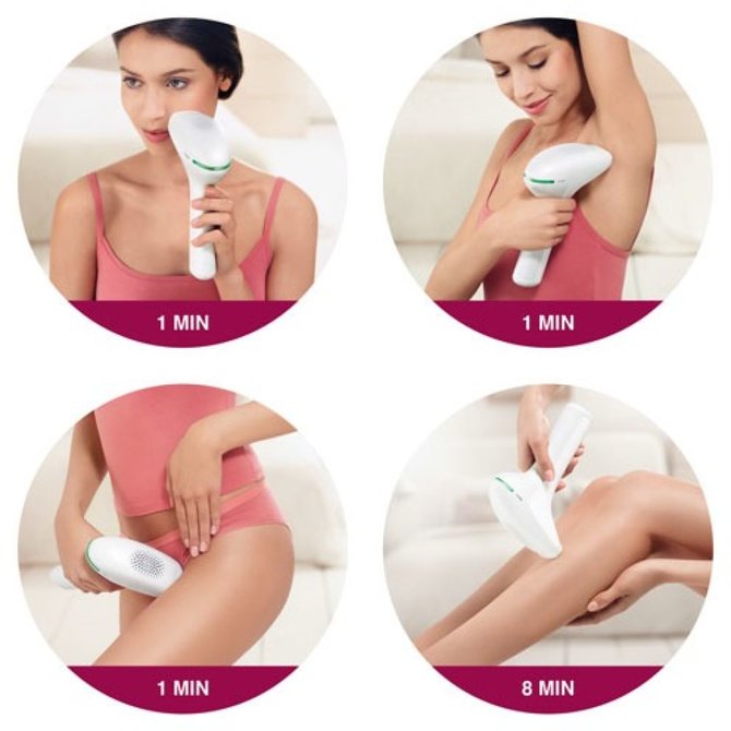 Partnerio nuotr./Philips Lumea fotoepilatorius SC2009