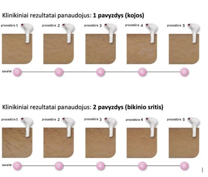 Partnerio nuotr./Klinikiniai rezultatai