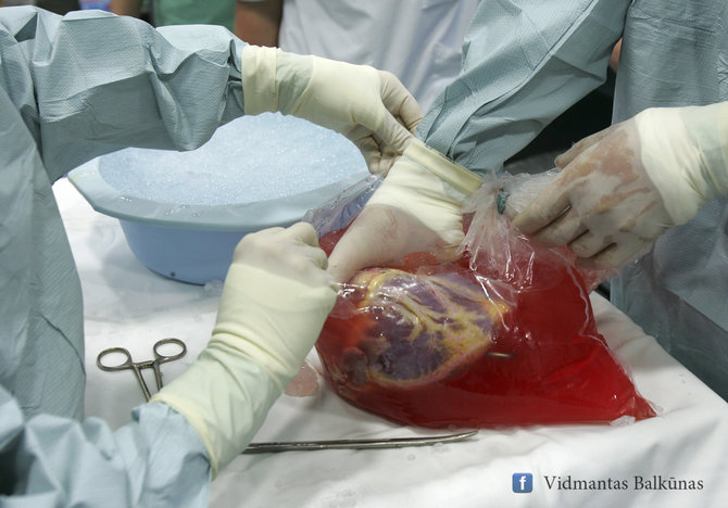 Širdies persodinimo operacija