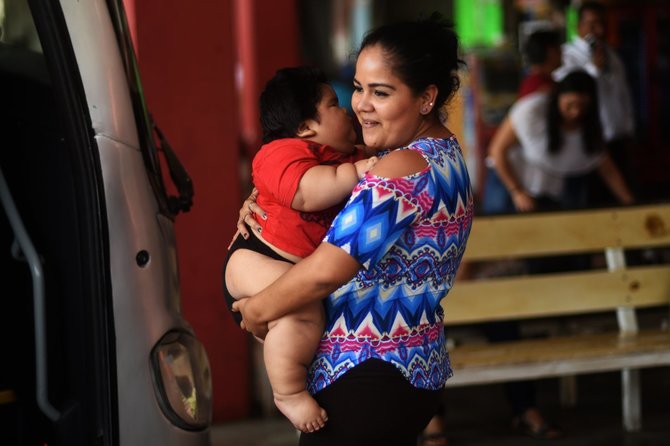AFP/„Scanpix“ nuotr./10 mėnesių meksikietis sveria 28 kilogramus, t.y. kaip 9 metų vaikas