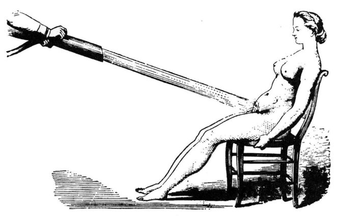 Wikimedia Commons nuotr./Vandens masažas - vienas būdų „isterijai“ gydyti