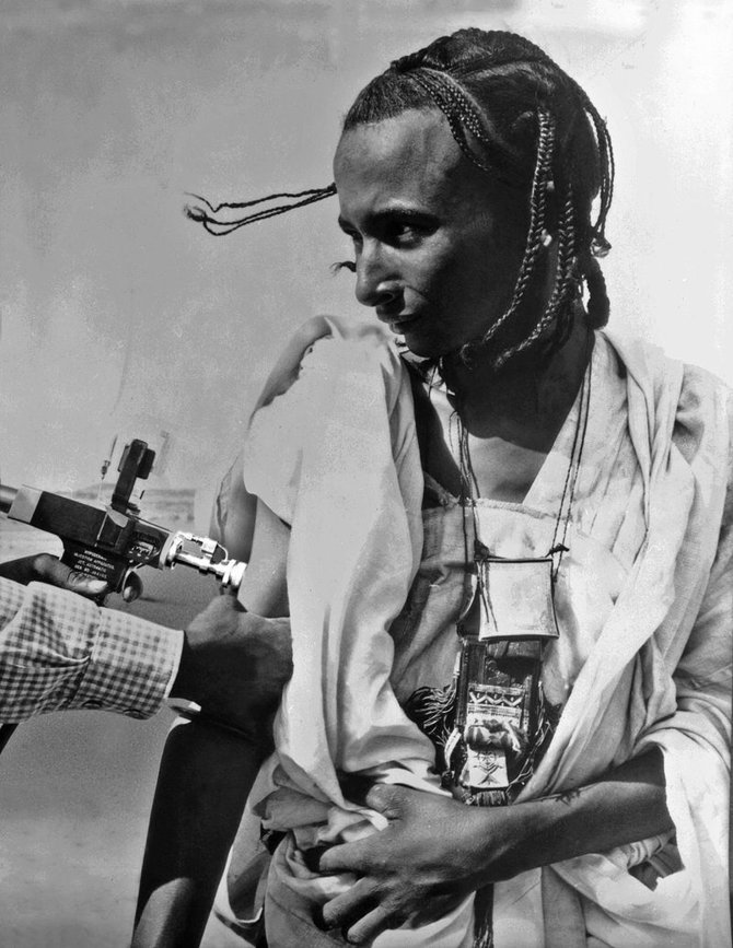 Afrikietis skiepijamas nuo raupų, 1969 m. 