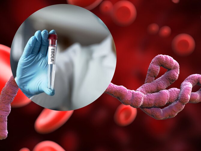 Shutterstock nuotr./Ebola
