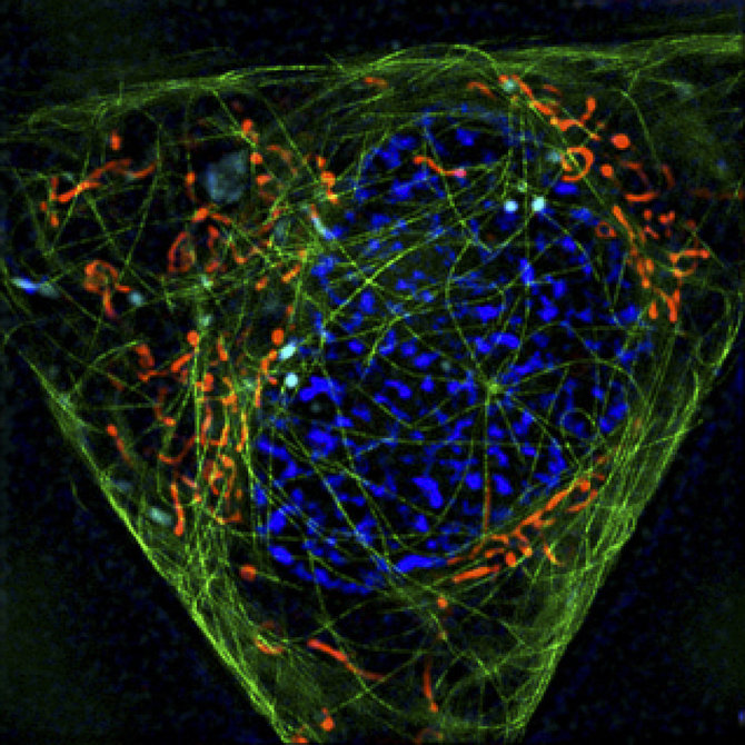 Gražvydo Lukinavičiaus iliustr./Daugiaspalvės superskiriamosios gebos mikroskopijos pavyzdys: žalia - ląstelės citoskeleto komponentas tubulinas, radona - ląstelės jėgainės mitochondrijos, šviesiai mėlyna – ląstelės virškinimo sistemos komponentas lizosomos, tamsiai mėlyna – ląstelės informacijos saugykla branduolys. Paveikslėlis 