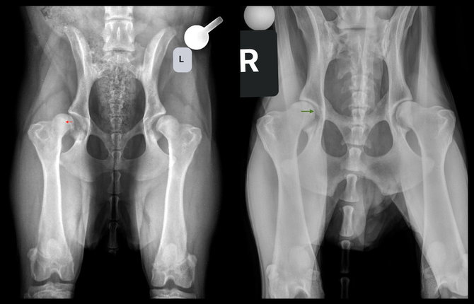 „Kaivanos“ klinikos rentgeno nuotr./Kairėje nuotraukoje – klubo sąnario rentgeno nuotrauka prieš operaciją, joje matoma dislokuota šlaunikaulio galvutė. Nuotraukoje dešinėje – sveiki klubų sąnariai po operacijos.