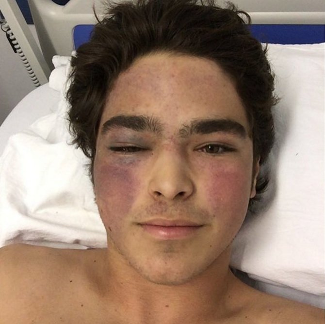 Nuotr. iš Pedro Piquet „Instagram“/Pedro Piquet po avarijos ligoninėje
