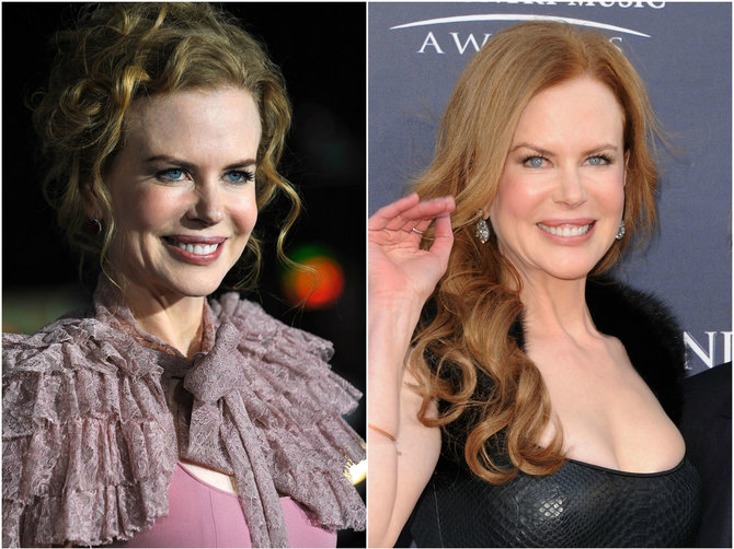 „Scanpix“ nuotr./Nicole Kidman 2009 (kairėje) ir 2011 metais.